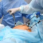 Laparoscopic Surgery